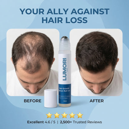 Lumori™ Hair Regrowth Treatment