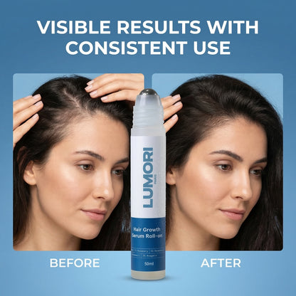 Lumori™ Hair Regrowth Treatment