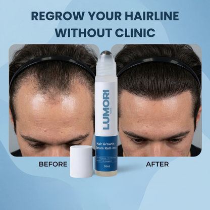 Lumori™ Hair Regrowth Treatment
