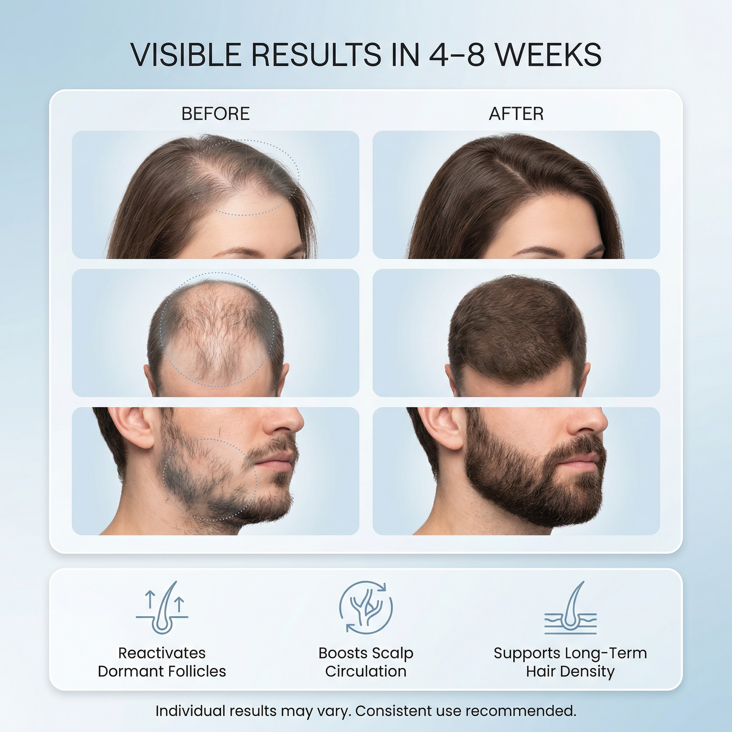 Lumori™ Hair Regrowth Treatment